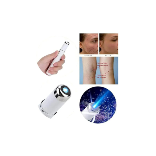 Acne Remover Blue Light Laser Pen