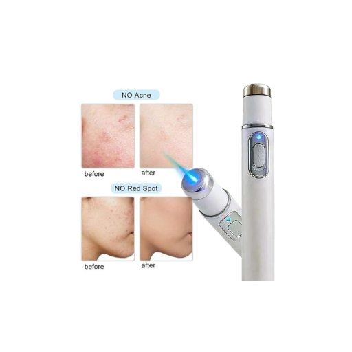 Acne Remover Blue Light Laser Pen