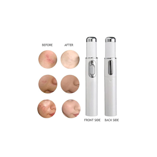 Acne Remover Blue Light Laser Pen