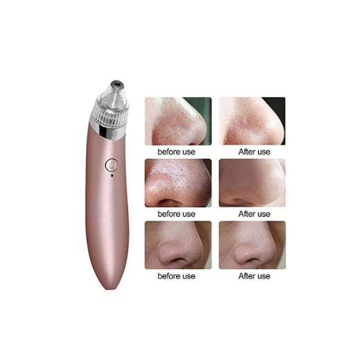 USB Rechargeable Derma Suction