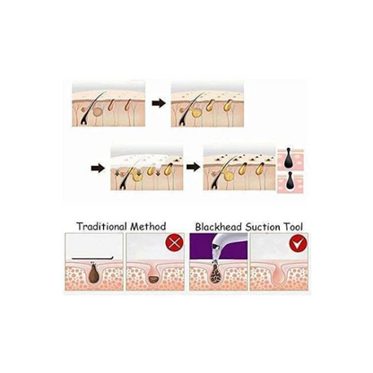 USB Rechargeable Derma Suction
